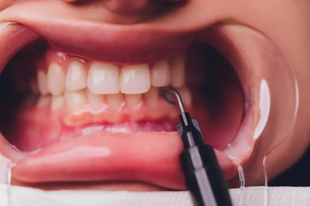 someone is cutting their teeth with a pair of scissors
