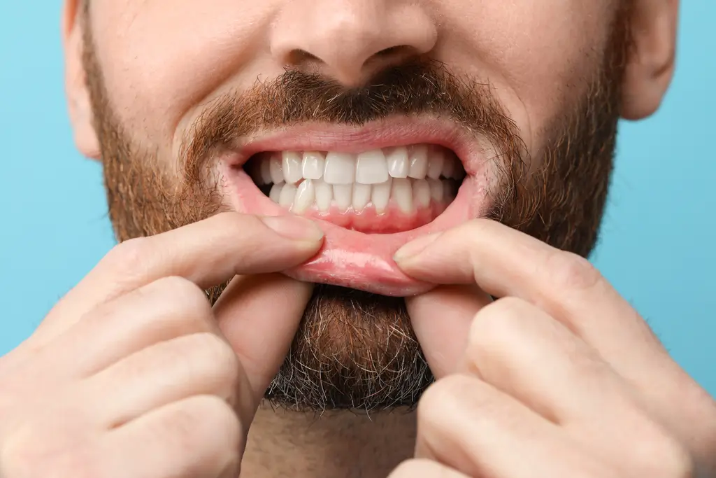 a close up of a man holding his teeth in front of his mouth