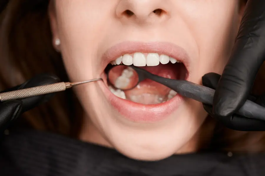 What Helps Sensitive Teeth
