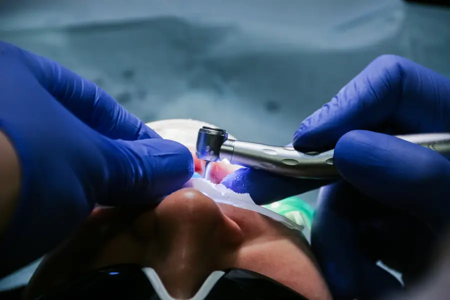 Benefits of Laser Dental Cleaning: Why It’s Worth Considering