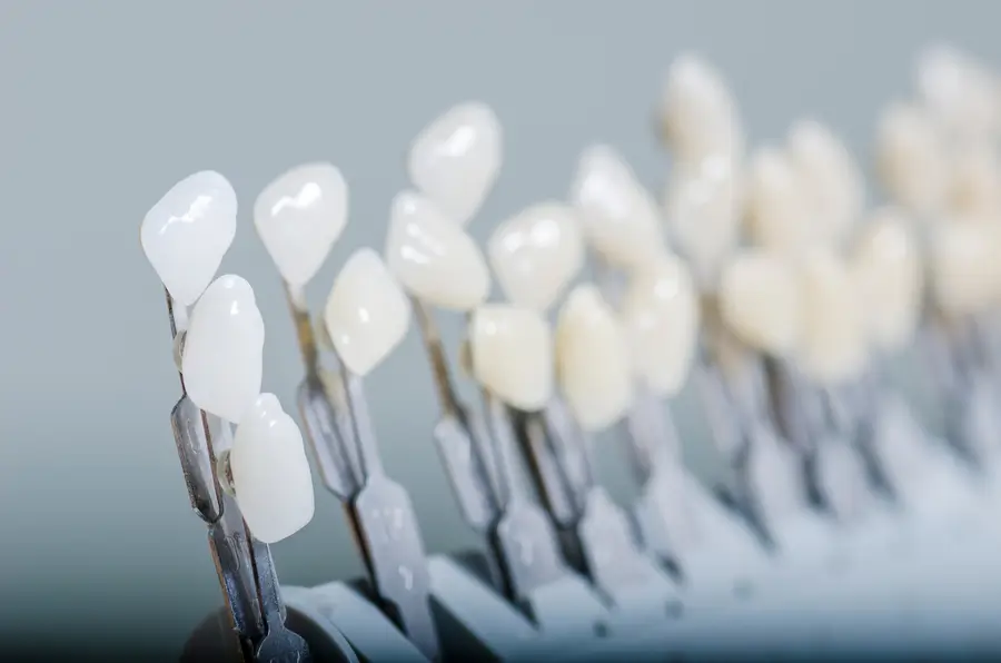 How Do Veneers Work? Key Facts from Advanced Dental Arts NYC