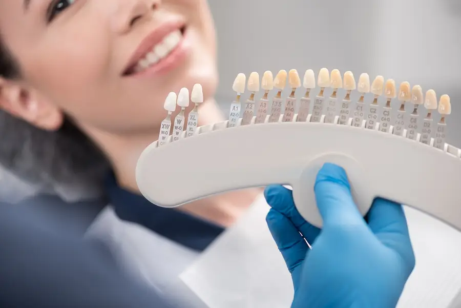 How Do Veneers Work? Key Facts from Advanced Dental Arts NYC