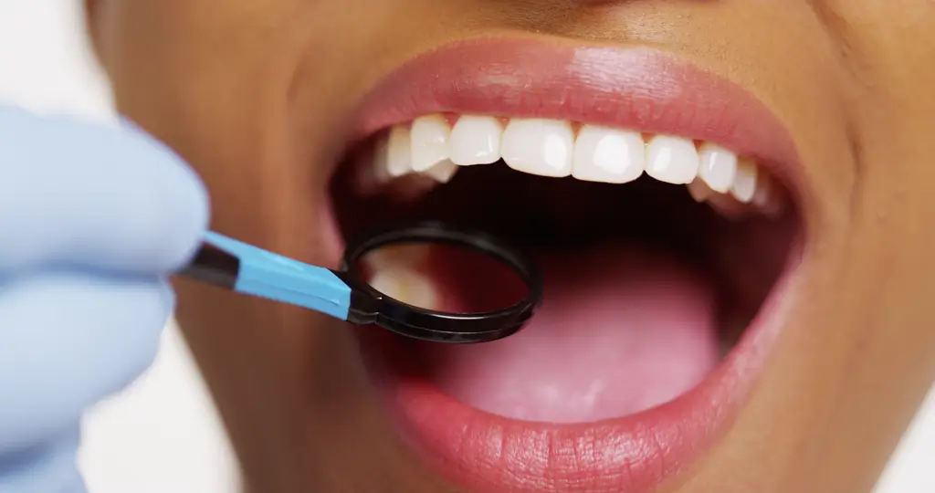 Close-up of a dental examination with a dental mirror being used to inspect healthy, white teeth.